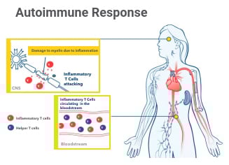 Autoimmune Response Diagram A diagram about the autoimmune response to multiple sclerosis.