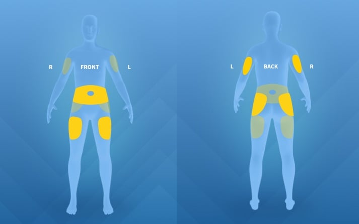 COPAXONE® Injection Sites A diagram of the three injection sites located on the front of the body and a diagram of the four injection sites on the back of the body for COPAXONE® therapy.